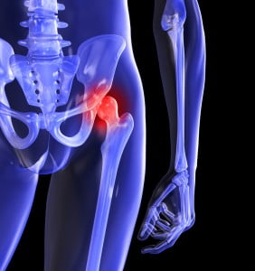 durere între genunchi și șold pentru a restabili tratamentul articulațiilor medicamente